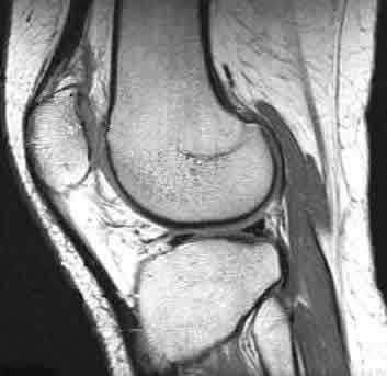 knee%20mri.jpg